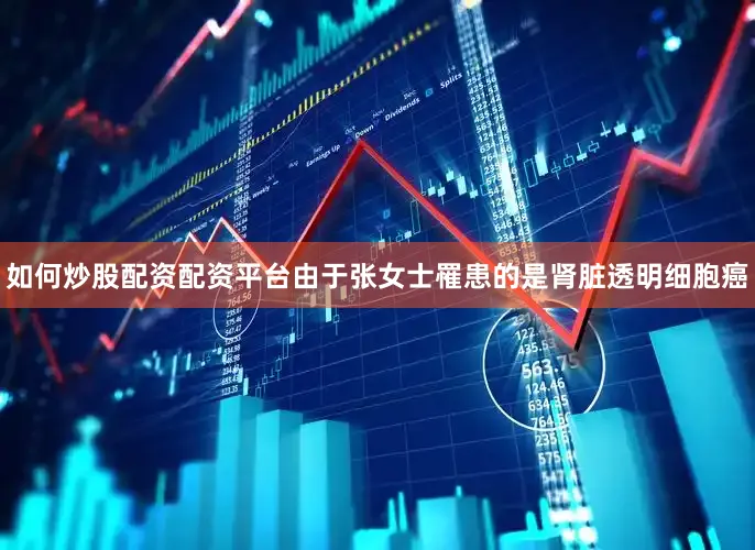 如何炒股配资配资平台由于张女士罹患的是肾脏透明细胞癌